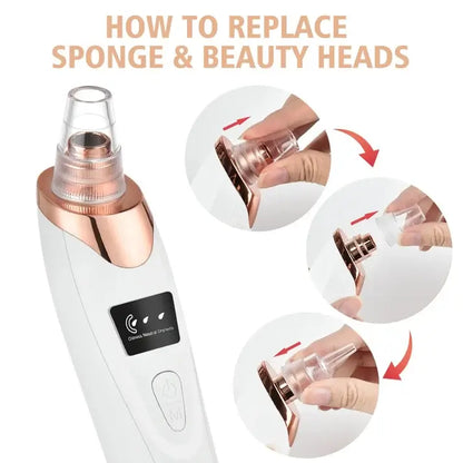 5-in-1 Electric Blackhead Remover & Pore Vacuum Cleaner – USB Rechargeable Facial Pore Cleaner