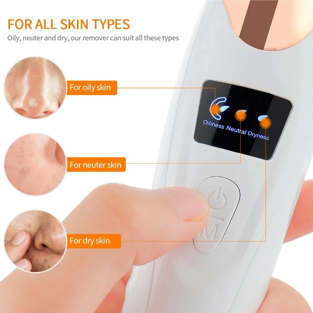 5-in-1 Electric Blackhead Remover & Pore Vacuum Cleaner – USB Rechargeable Facial Pore Cleaner